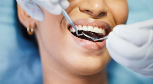 Best Emergency Dentist for Lost Fillings or Crowns in Vley Grande, AL